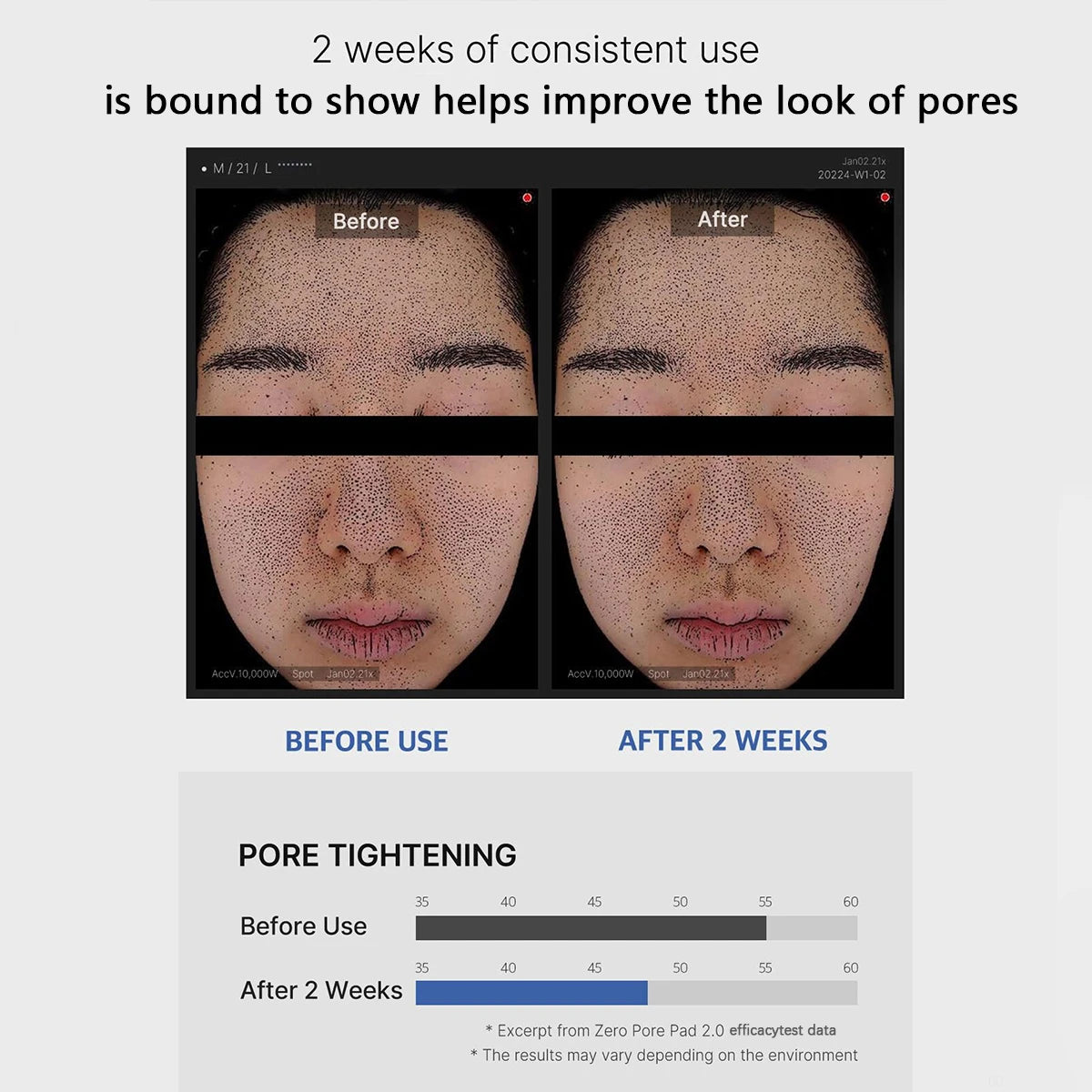 MEDICUBE🫧- ZERO PORE PAD 2.0